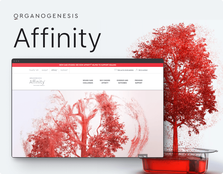 affinity